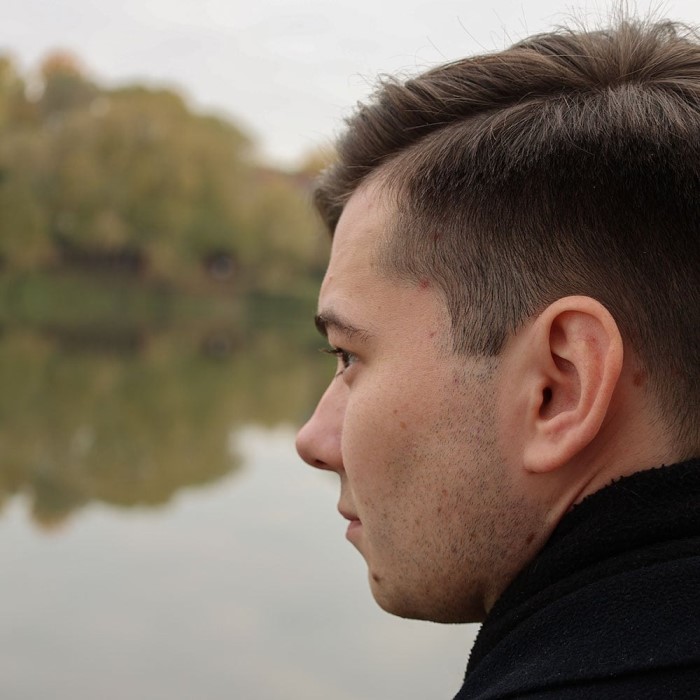 accutane hair loss before and after